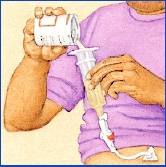 Hands pouring liquid food from can into syringe attached to feeding tube port.
