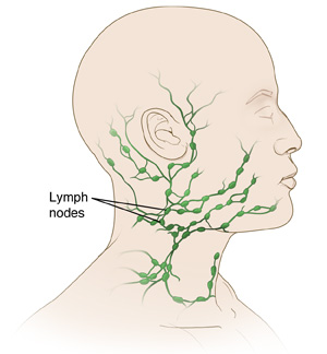 Side view of the neck and head showing the lymph nodes.