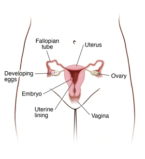 Front view of woman's pelvis showing cross section of uterus, ovaries, cervix, vagina, and fallopian tubes. Embryo is implanted in wall of uterus.