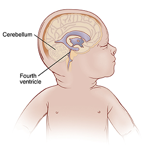 Side view of baby's head showing normal ventricles in brain.