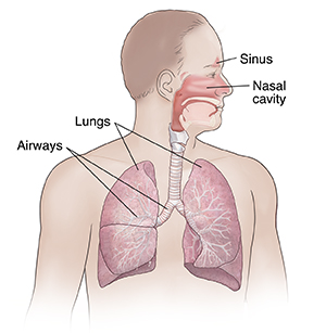 Outline of person's upper body showing respiratory system, including sinus, nasal cavity, lungs, and airways.