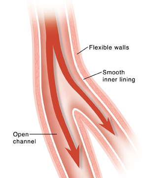 Cross section of healthy artery with normal blood flow.