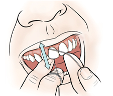 Primer plano de una boca en donde se ven las manos pasando el hilo entre los dientes.