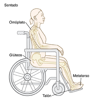Bosquejo de una persona sentada en una silla de ruedas con los huesos visibles. Los círculos indican los puntos de presión: los omóplatos, las nalgas, el antepié y el talón.