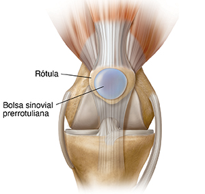 Vista frontal de la articulación de la rodilla donde se observa la bursa prepatelar.